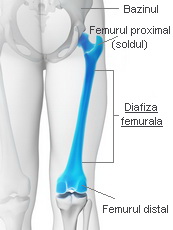 Articulație falsă pentru tratamentul fracturilor de șold. Навигация по записям