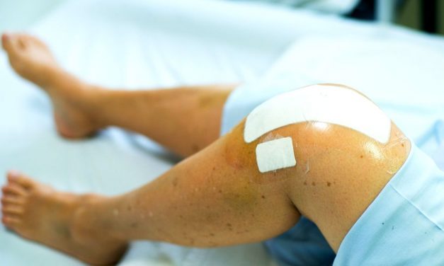 Recuperare artroscopie genunchi | CENTROKINETIC