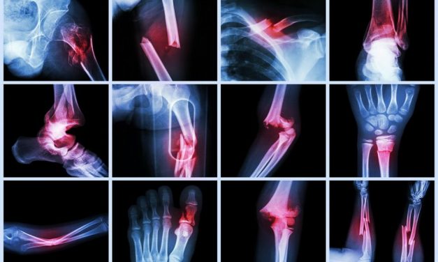 calmant pentru unguent pentru dureri articulare deformarea artrozei simptomelor articulațiilor genunchiului