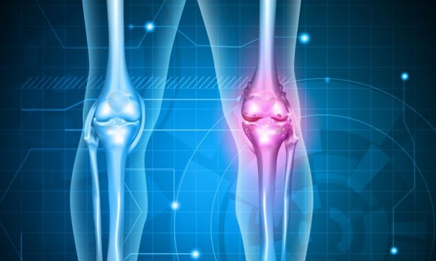 osteoporoza genunchiului