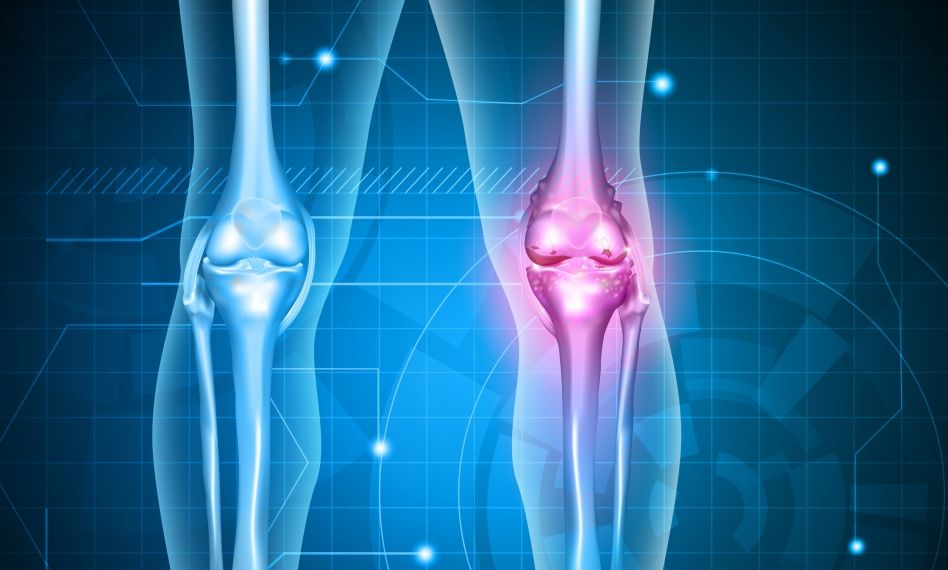 artrita artroza genunchiului decât a trata)
